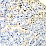 DCTD Polyclonal Antibody