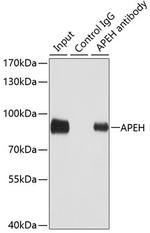 APEH Antibody in Immunoprecipitation (IP)