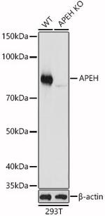 APEH Antibody in Western Blot (WB)
