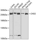 CHD2 Polyclonal Antibody