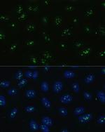 NOLC1 Polyclonal Antibody