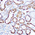 MAP4 Polyclonal Antibody