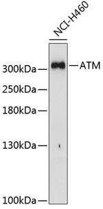 ATM Antibody in Western Blot (WB)