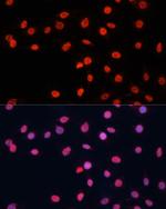 FUS Antibody in Immunocytochemistry (ICC/IF)