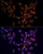 RPL10A Polyclonal Antibody