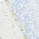 RPL10A Antibody in Immunohistochemistry (Paraffin) (IHC (P))