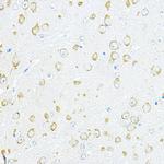 RPL10A Antibody in Immunohistochemistry (Paraffin) (IHC (P))