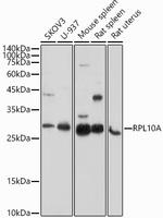 RPL10A Antibody in Western Blot (WB)