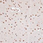 RBM3 Antibody in Immunohistochemistry (Paraffin) (IHC (P))