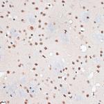 RBM3 Antibody in Immunohistochemistry (Paraffin) (IHC (P))