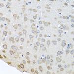 PABPC4 Antibody in Immunohistochemistry (Paraffin) (IHC (P))