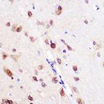 CUGBP1 Antibody in Immunohistochemistry (Paraffin) (IHC (P))