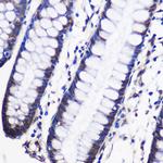 CUGBP1 Polyclonal Antibody