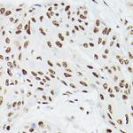 CPSF6 Antibody in Immunohistochemistry (Paraffin) (IHC (P))