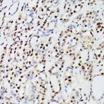 CPSF6 Antibody in Immunohistochemistry (Paraffin) (IHC (P))