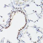 CPSF6 Antibody in Immunohistochemistry (Paraffin) (IHC (P))