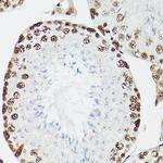CPSF6 Antibody in Immunohistochemistry (Paraffin) (IHC (P))