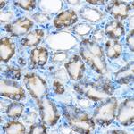 MRPL13 Antibody in Immunohistochemistry (Paraffin) (IHC (P))
