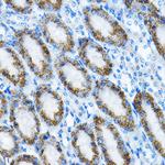 MRPL13 Polyclonal Antibody