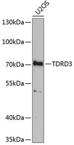 TDRD3 Polyclonal Antibody