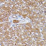 HDLBP Antibody in Immunohistochemistry (Paraffin) (IHC (P))