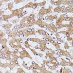 HDLBP Antibody in Immunohistochemistry (Paraffin) (IHC (P))
