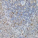 PRPF4 Antibody in Immunohistochemistry (Paraffin) (IHC (P))