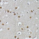 PRPF4 Antibody in Immunohistochemistry (Paraffin) (IHC (P))