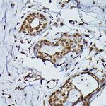 PRPF4 Polyclonal Antibody