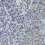 PRPF4 Antibody in Immunohistochemistry (Paraffin) (IHC (P))
