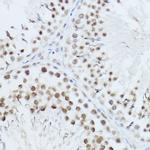SRRM1 Antibody in Immunohistochemistry (Paraffin) (IHC (P))