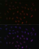 SRSF3 Antibody in Immunocytochemistry (ICC/IF)