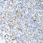 TIAL1 Polyclonal Antibody