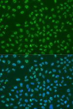 HuR Polyclonal Antibody