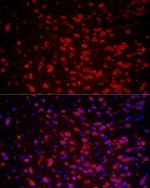 HuC Polyclonal Antibody