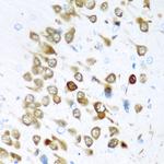 HuC Antibody in Immunohistochemistry (Paraffin) (IHC (P))