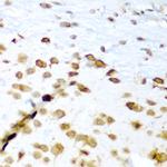HuC Antibody in Immunohistochemistry (Paraffin) (IHC (P))