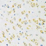 FMRP Antibody in Immunohistochemistry (Paraffin) (IHC (P))