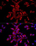 IGF2BP3 Polyclonal Antibody