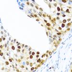 KHDRBS2 Antibody in Immunohistochemistry (Paraffin) (IHC (P))