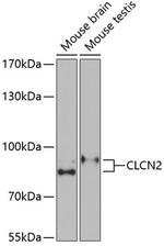 CLCN2 Polyclonal Antibody