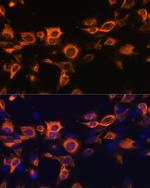 GM-CSF Antibody in Immunocytochemistry (ICC/IF)