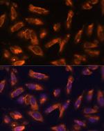GM-CSF Polyclonal Antibody