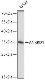 CARP Polyclonal Antibody