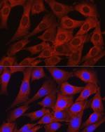 Osteocalcin Polyclonal Antibody