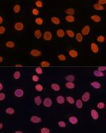 TADA3L Polyclonal Antibody