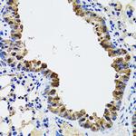ESD Antibody in Immunohistochemistry (Paraffin) (IHC (P))