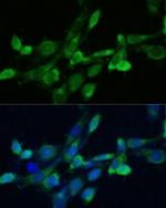 FDFT1 Polyclonal Antibody