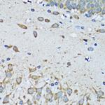 FDFT1 Antibody in Immunohistochemistry (Paraffin) (IHC (P))