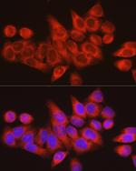 ARMET Antibody in Immunocytochemistry (ICC/IF)